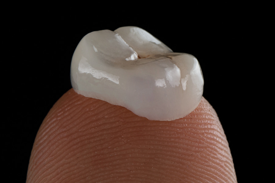 image of a dental crown, placed on a fingertip for scale